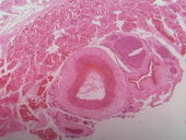 Arterie svalového typu - příčný řez