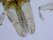 Klíště obecné (Ixodes ricinus) - samice, detail